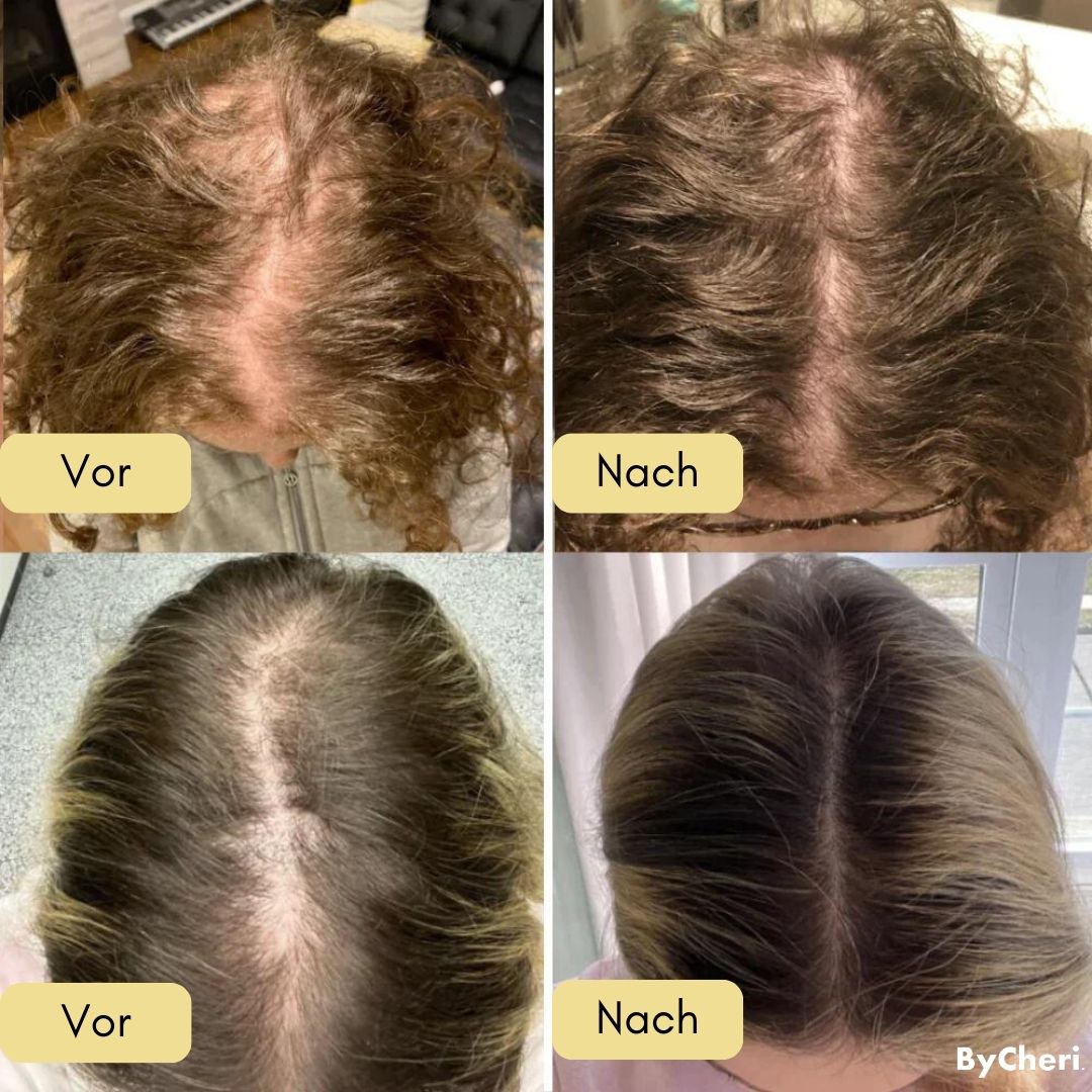 VitalGrow™ | Your Natural Oil Treatment for Hair Growth | 50% OFF
