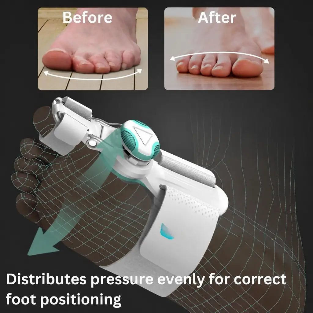 OrthoAlign™ – Big Toe Corrector | 1+1 FREE - Nestilia