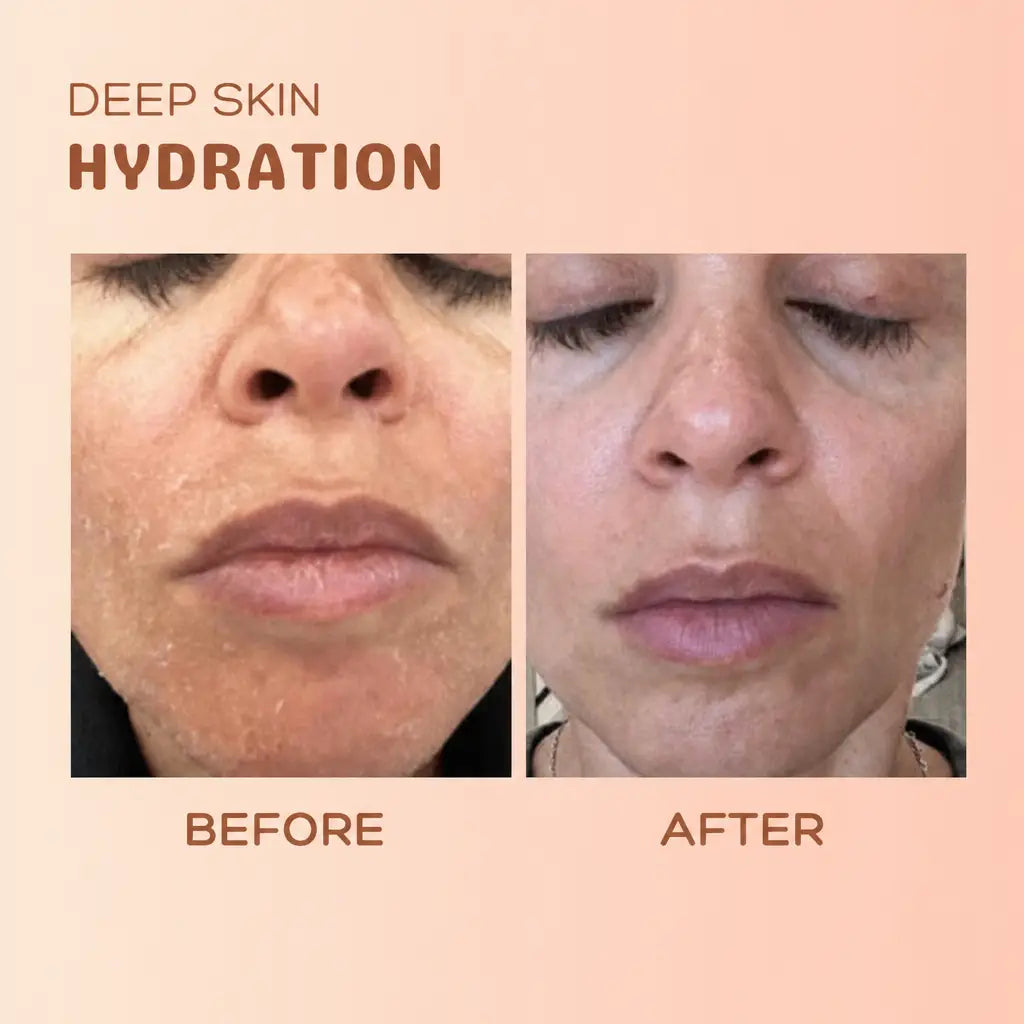 MultiBalm⢠- Anti-Wrinkle Skin Renewal Balm | 1+1 FREE - Nestilia