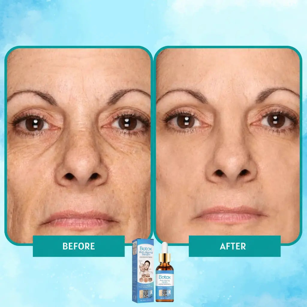 YouthGlow™ - Before and after results - Nestilia