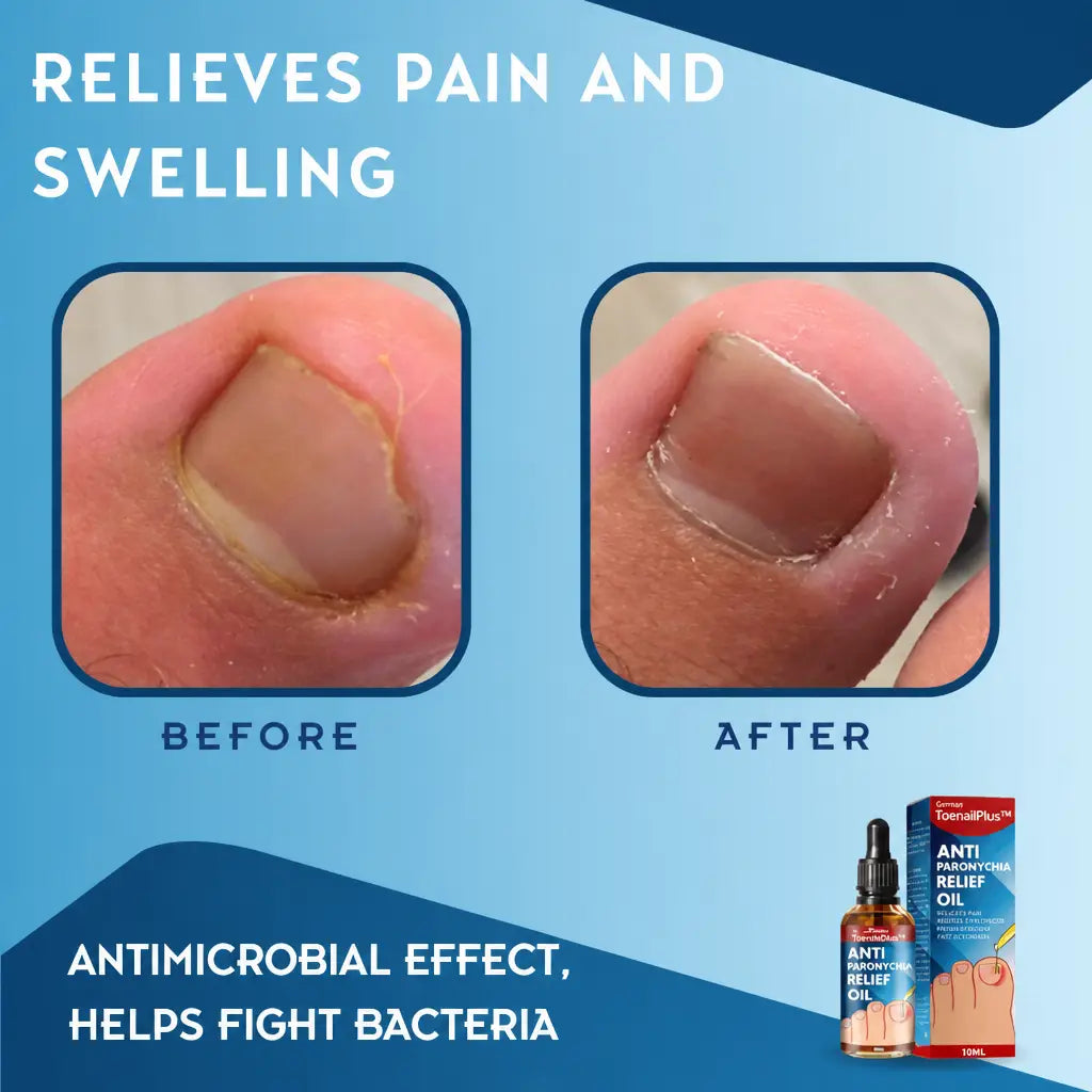 ToePerfect™ Relieves Pain and Swelling | Nestilia