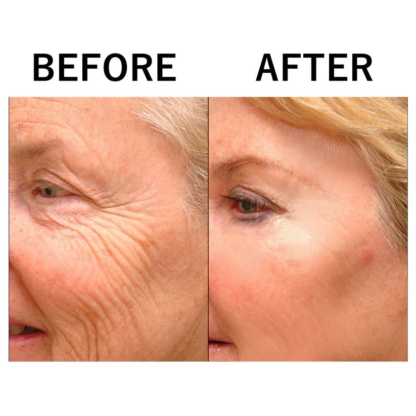 1 + 1 FREE TODAY | HydraLift™