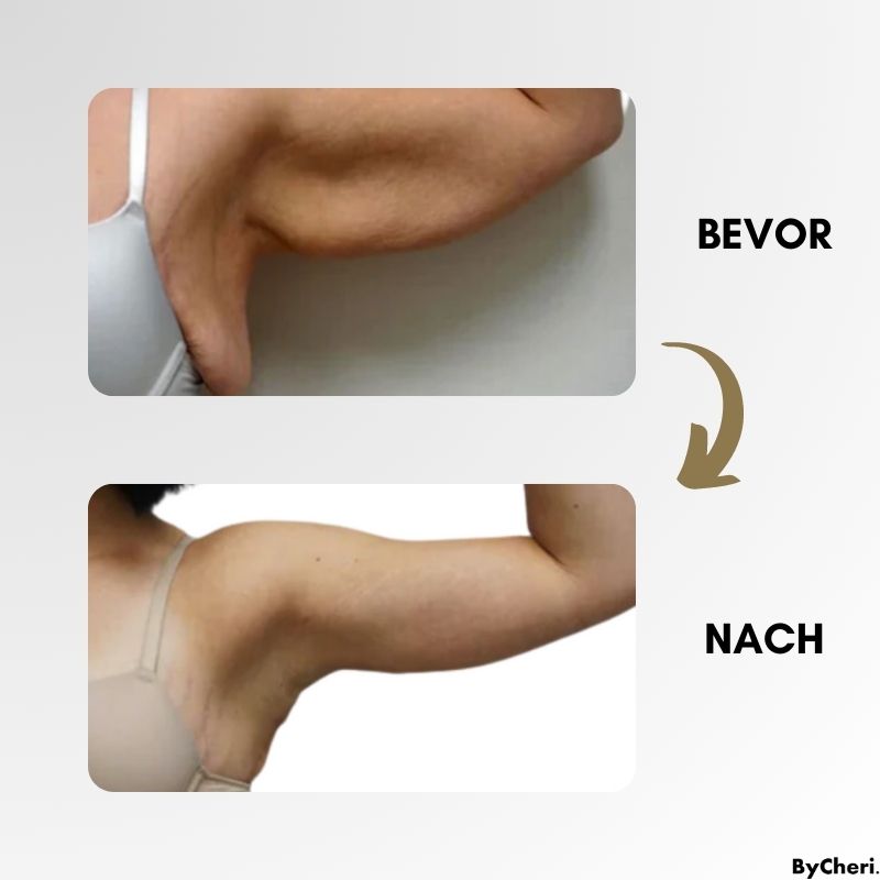 LAST DAY 50% OFF | LymphMag™ | Feel Different in Weeks - ByCheri