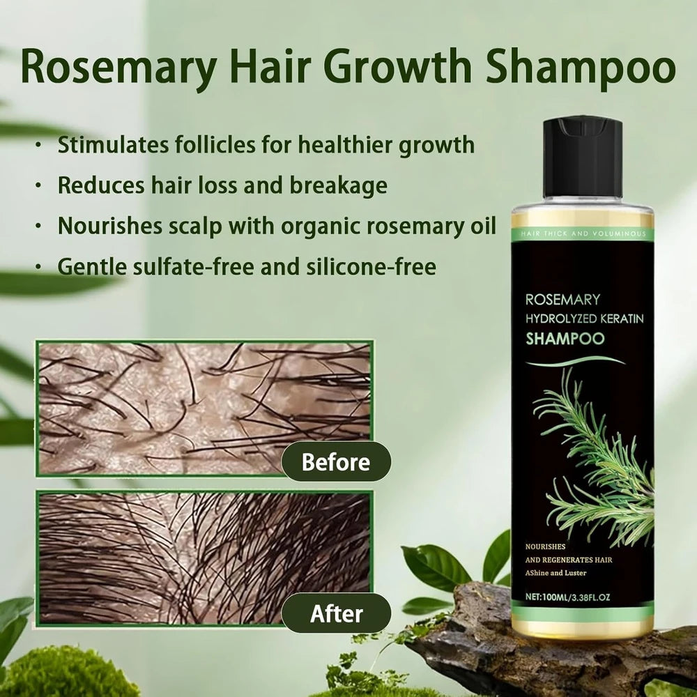 1+1 FREE TODAY | KeraBloom™ - Hair Growth Shampoo