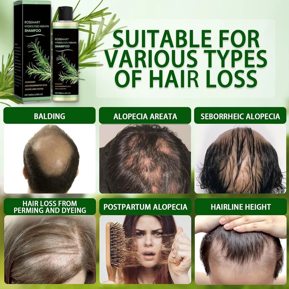 1+1 FREE TODAY | KeraBloom™ - Hair Growth Shampoo