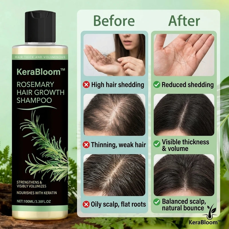 1+1 FREE TODAY | KeraBloom™ - Hair Growth Shampoo