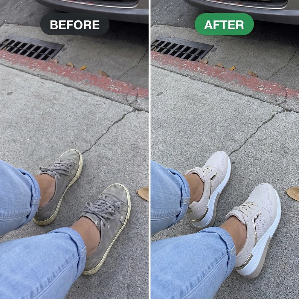 50% OFF TODAY | Elois™ - Feel free and stylish - sneakers for women