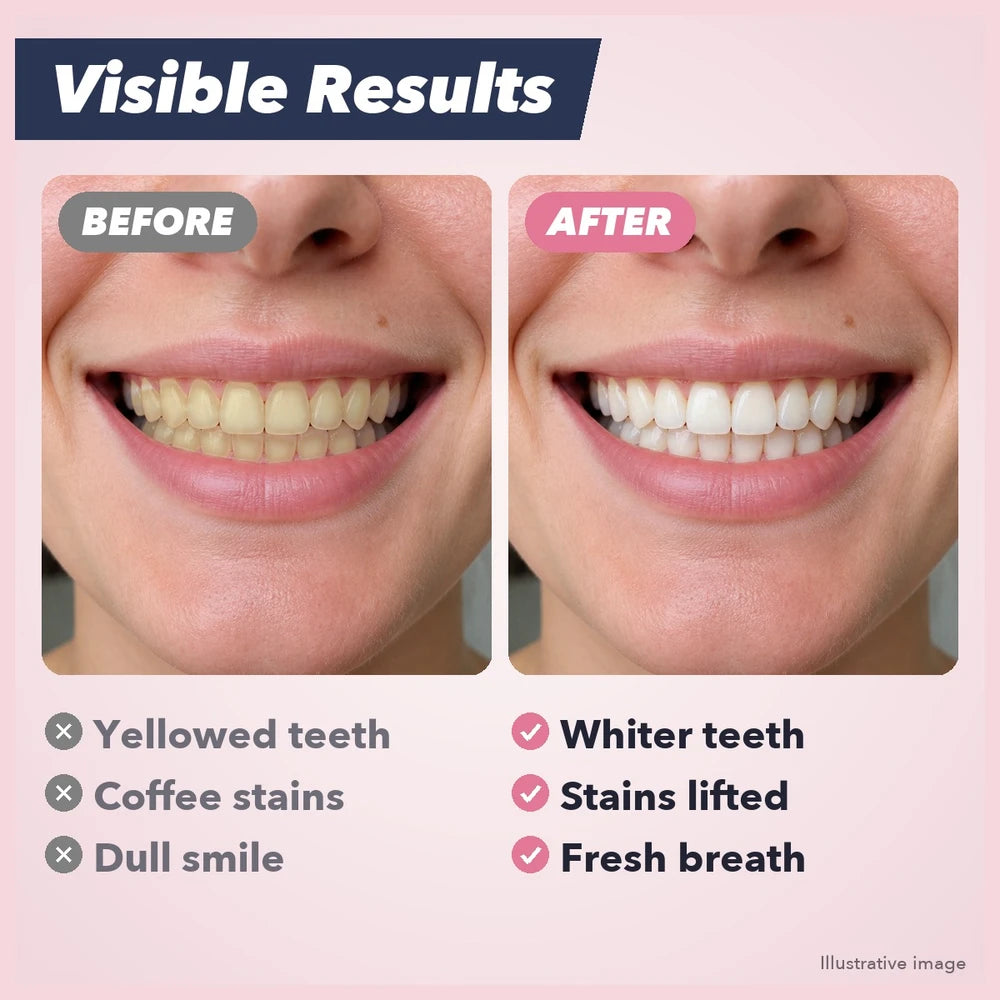 1+1 FREE TODAY | CleanStain™ - Stain Removal Toothpaste