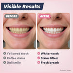1+1 FREE TODAY | CleanStain™ - Stain Removal Toothpaste