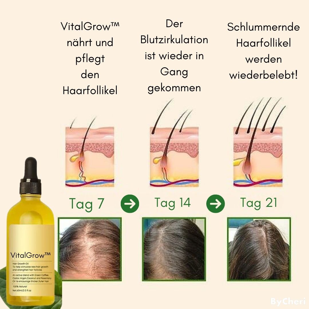 VitalGrow™ | Your Natural Oil Treatment for Hair Growth | 50% OFF