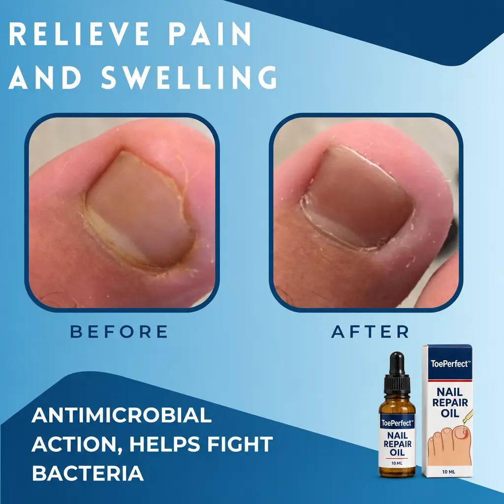 1+1 FREE TODAY | ToePerfect™ - Heals toenails and fingernails