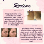 50% OFF TODAY | SpotlessXpert™ - Electric Beauty Spot Remover