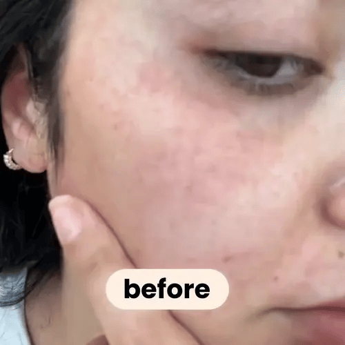 50% OFF TODAY  SpotFade™ - Brightening Pads