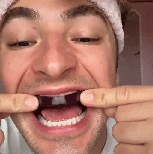 1 + 1 FREE TODAY  OraGlow™ Teeth Whitening Strips