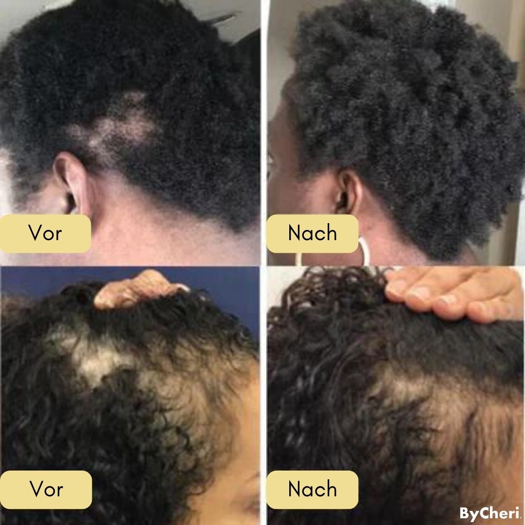 VitalGrow™ | Your Natural Oil Treatment for Hair Growth | 50% OFF