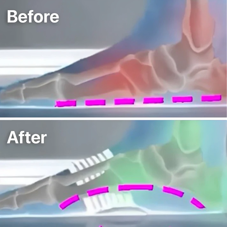 1 + 1 FREE TODAY | StepRelief™ | Orthopedic Foot Arch Support