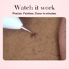 50% OFF TODAY | SpotlessXpert™ - Electric Beauty Spot Remover