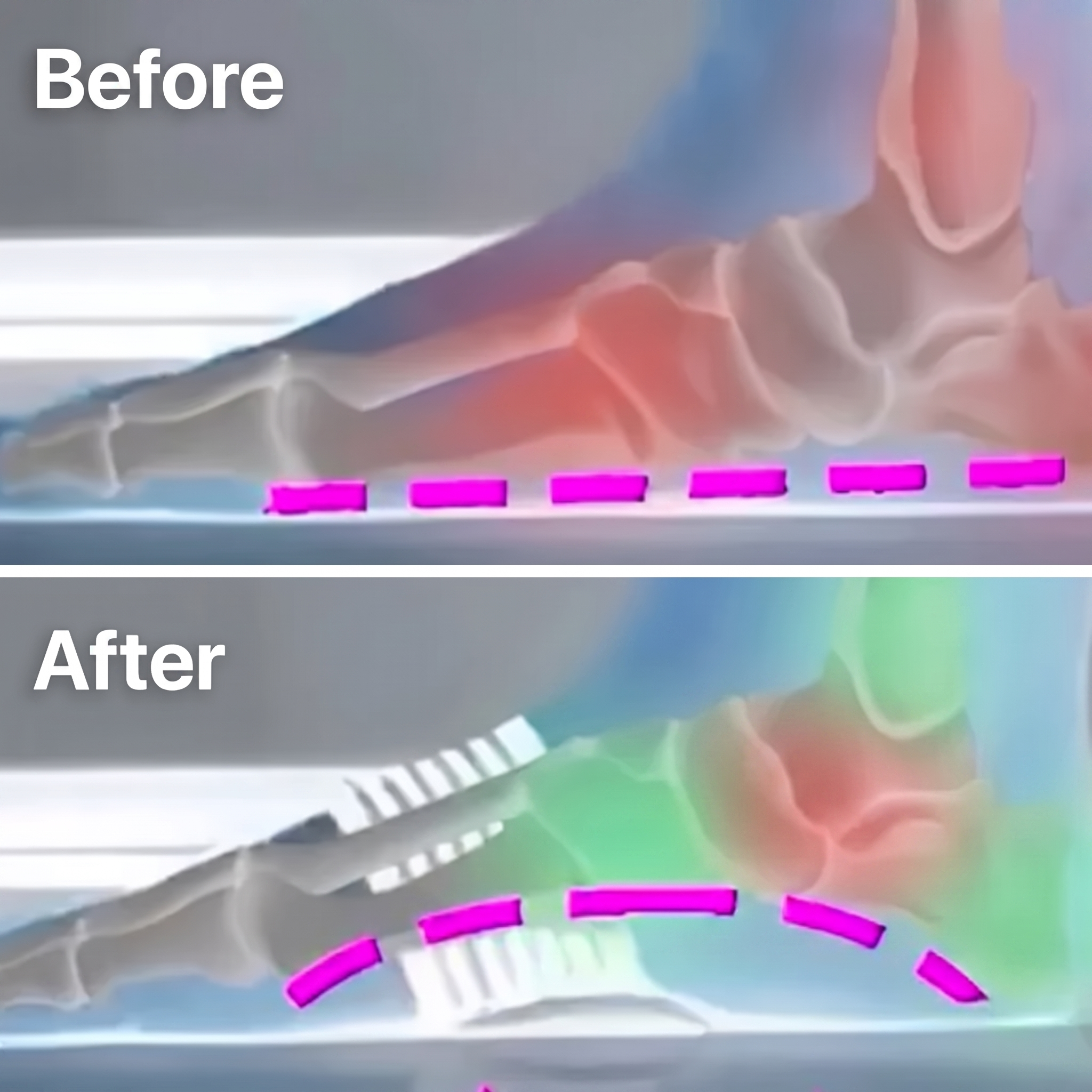 50% OFF TODAY | StepRelief™ - Orthopedic Arch Support