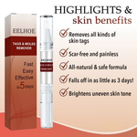 50% OFF TODAY  | ClearMole™ - Skin Tag & Wart Remover