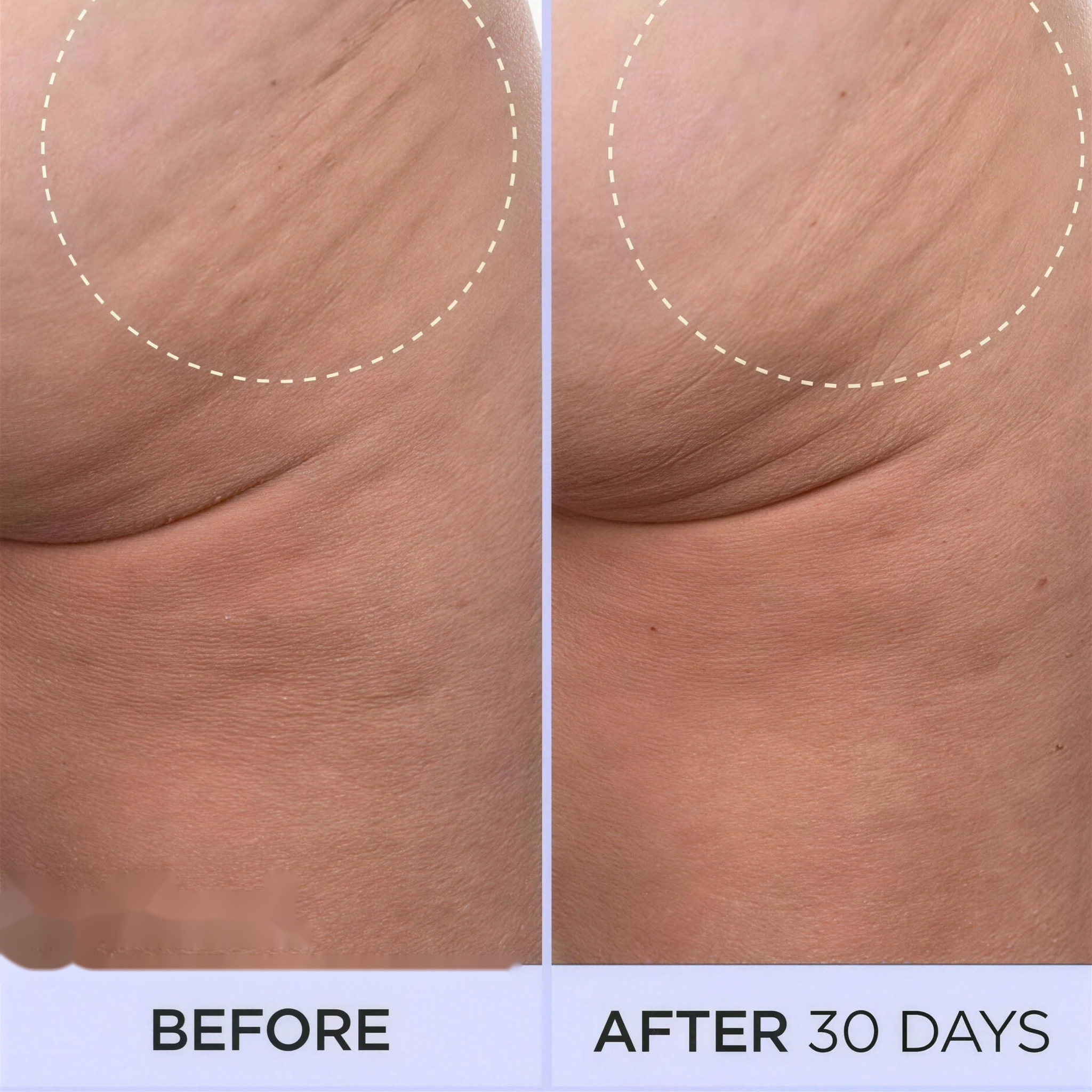 1+1 FREE TODAY | SmoothSculpt™ - Say hello to visibly firmer skin!