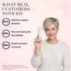 50% OFF TODAY | SpotlessXpert™ - Electric Beauty Spot Remover