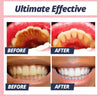 1+1 FREE TODAY | CleanStain™ - Stain Removal Toothpaste
