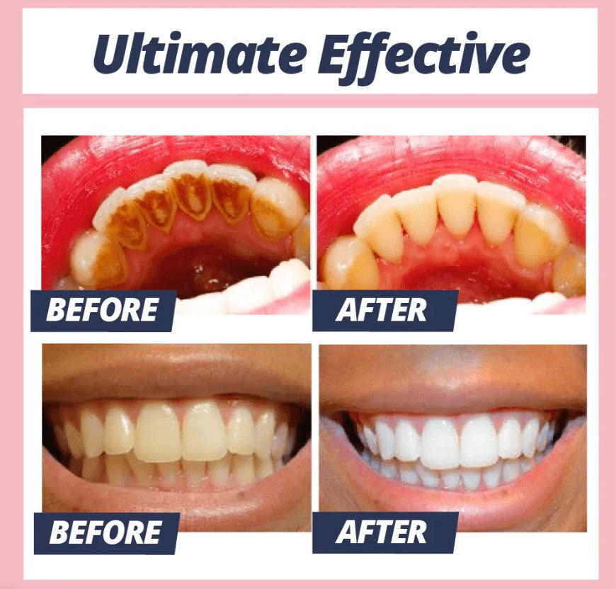 1+1 FREE TODAY | CleanStain™ - Stain Removal Toothpaste