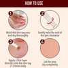 50% OFF TODAY  | ClearMole™ - Skin Tag & Wart Remover