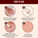 50% OFF TODAY  | ClearMole™ - Skin Tag & Wart Remover