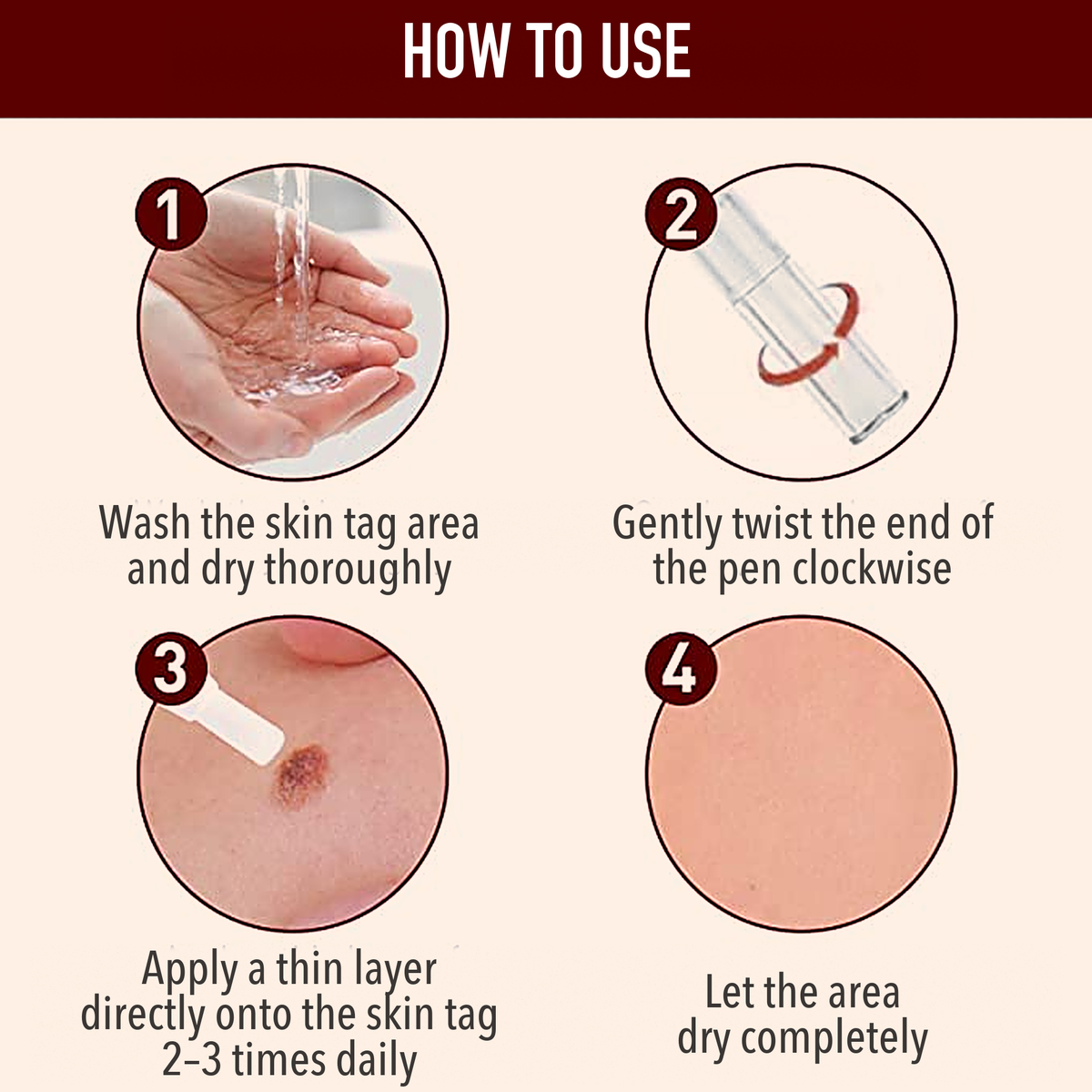 50% OFF TODAY  | ClearMole™ - Skin Tag & Wart Remover