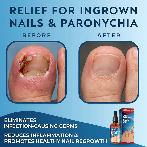 1+1 FREE TODAY  ToePerfect™ - Heals toenails and fingernails