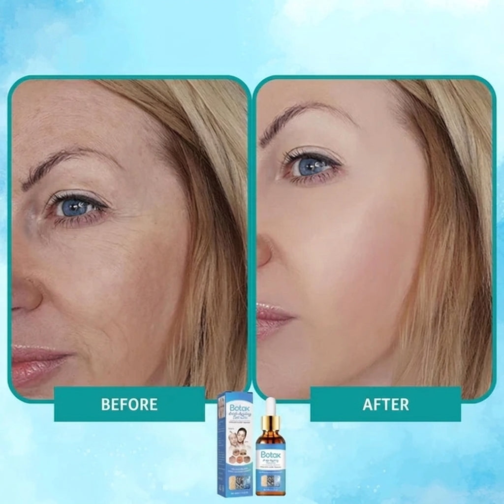 1 + 1 FREE TODAY | YouthGlow™ - Botox Anti-Aging Serum