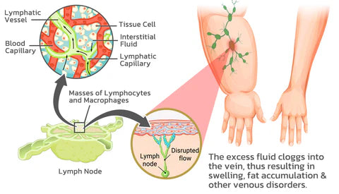 50% OFF TODAY  LymphMag™ - Feel different in weeks