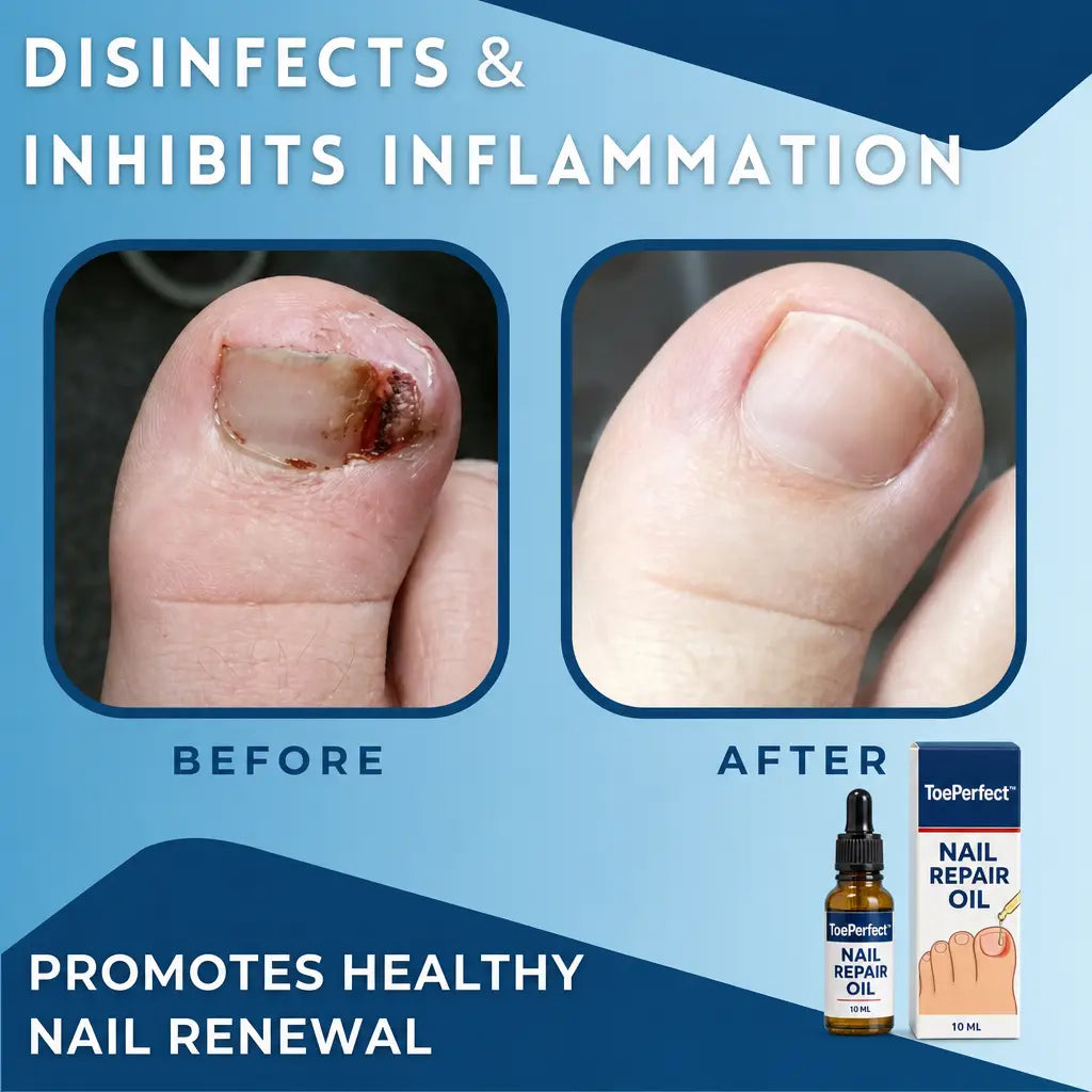 1+1 FREE TODAY | ToePerfect™ - Heals toenails and fingernails