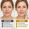 1+1 FREE TODAY | BotoxLux™ - Bee Venom Cream