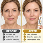 1+1 FREE TODAY | BotoxLux™ - Bee Venom Cream
