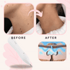50% OFF TODAY | SpotlessXpert™ - Electric Beauty Spot Remover