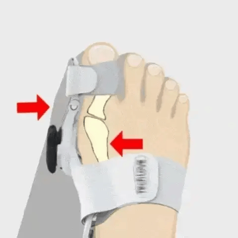 1 + 1 FREE TODAY  OrthoAlign™ - Big Toe Corrector