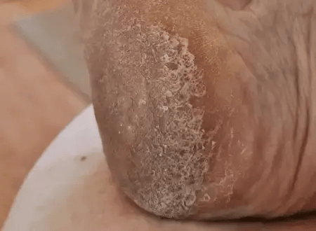 1 + 1 FREE TODAY  FootVitalize™ - Foot Finish Foot Repair Cream