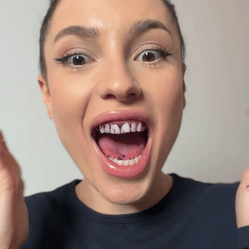 1 + 1 FREE TODAY  OraGlow™ Teeth Whitening Strips
