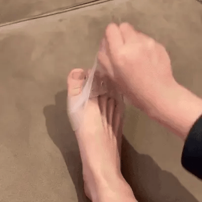 50% OFF TODAY  ToeAlign™ - Comfort Therapy Toe Separator Insoles