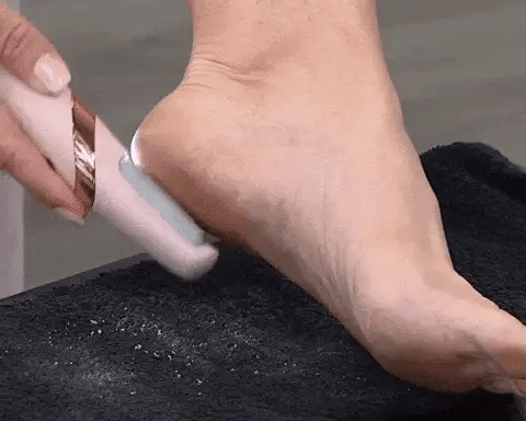 50% OFF TODAY  CallusMaster™ - Electric Callus Remover