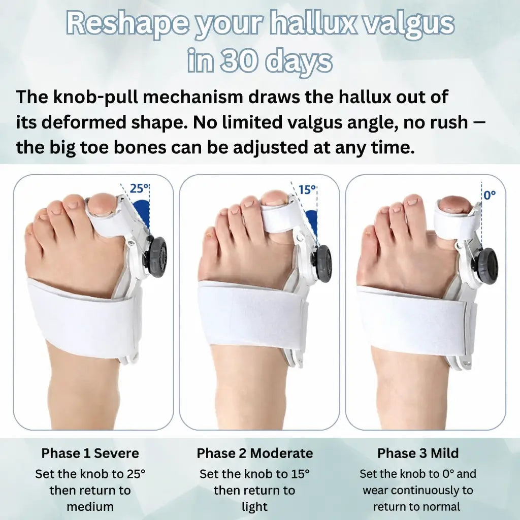 OrthoAlign™ – Big Toe Corrector | 1+1 FREE - Nestilia