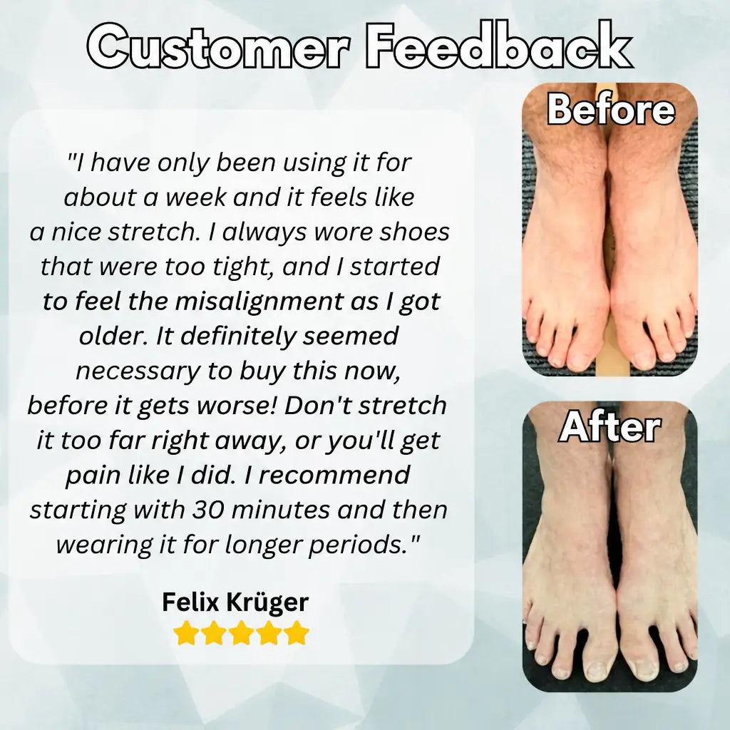 OrthoAlign™ – Big Toe Corrector | 1+1 FREE - Nestilia