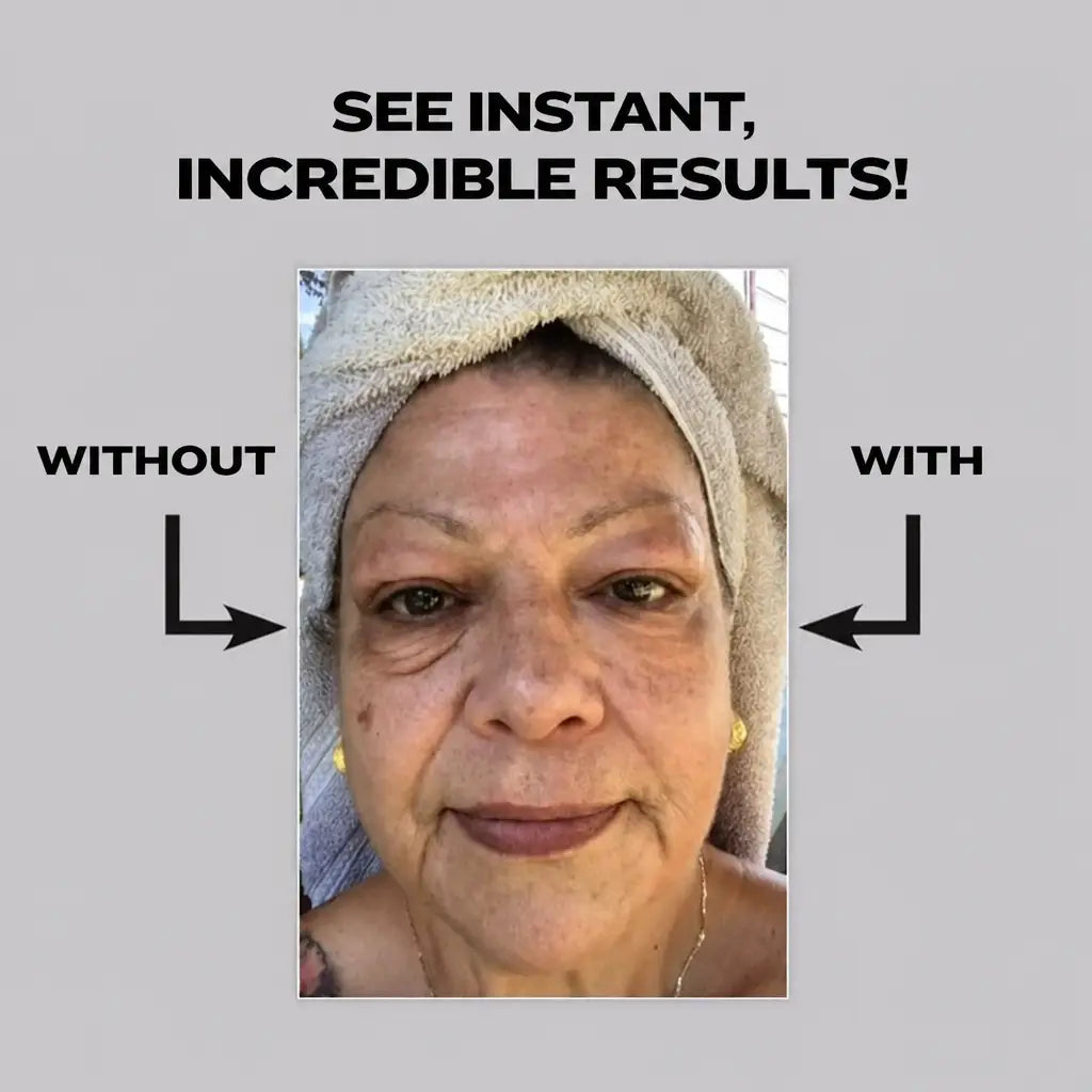EyeRejuv™ - Wrinkle-Removing Eye Cream! | 1+1 FREE TODAY! - Nestilia