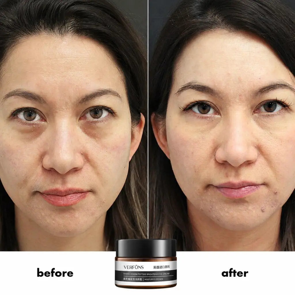 EyeRejuv™ - Wrinkle-Removing Eye Cream! | 1+1 FREE TODAY! - Nestilia