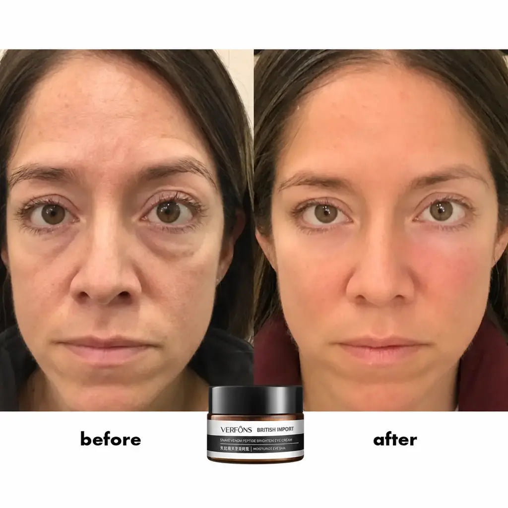 EyeRejuv™ - Wrinkle-Removing Eye Cream! | 1+1 FREE TODAY! - Nestilia
