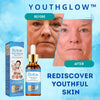 YouthGlow™ Botox Anti-Aging Serum - Rediscover youthful skin - Nestilia