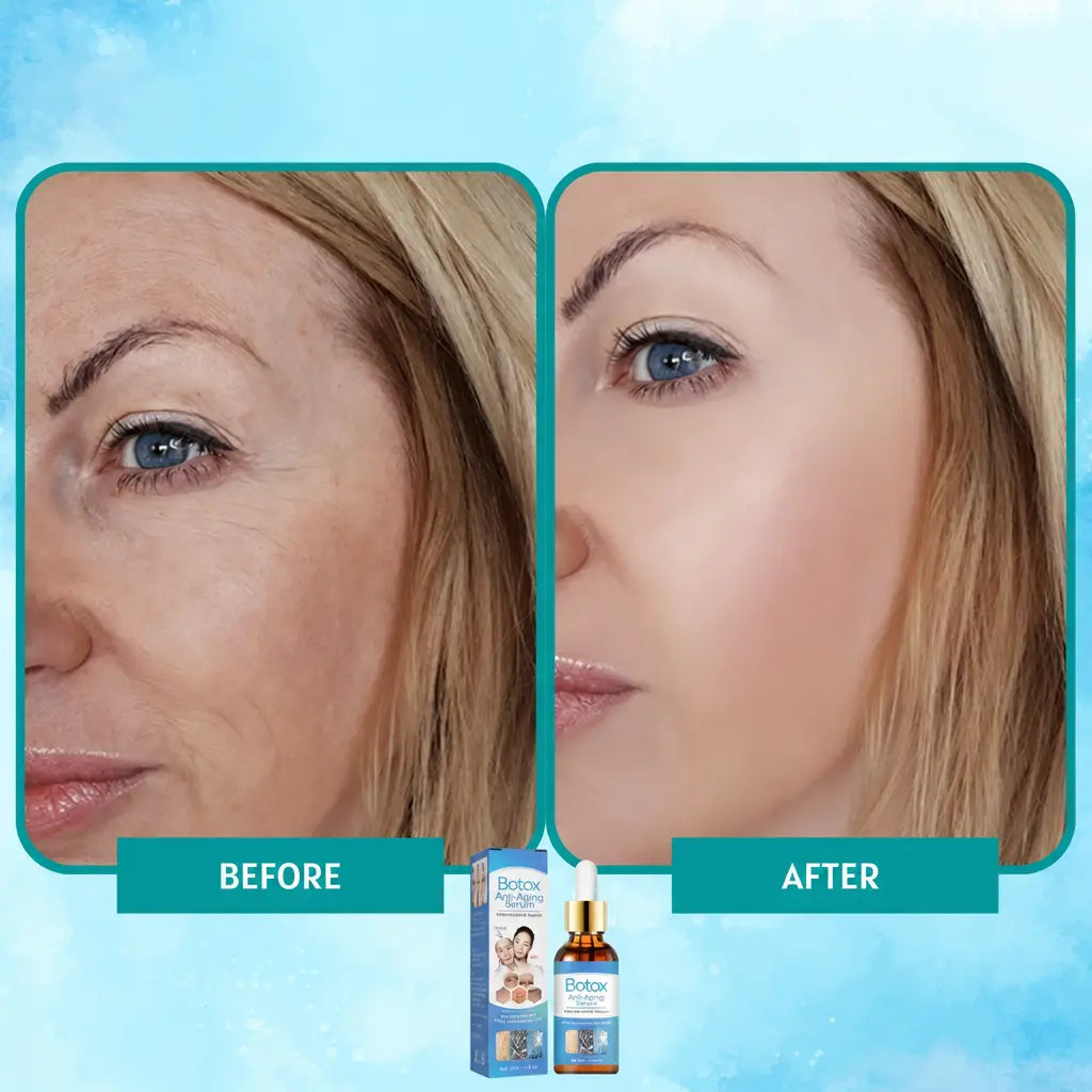 YouthGlow™ - Before and after results - Nestilia