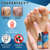 ToePerfect™ Healing Toenail and Fingernail Treatment | Nestilia